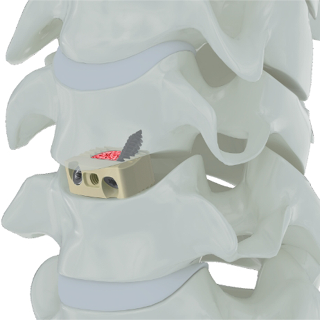 Trauhui Interbey Founde Cagage-cazaales айнымалы