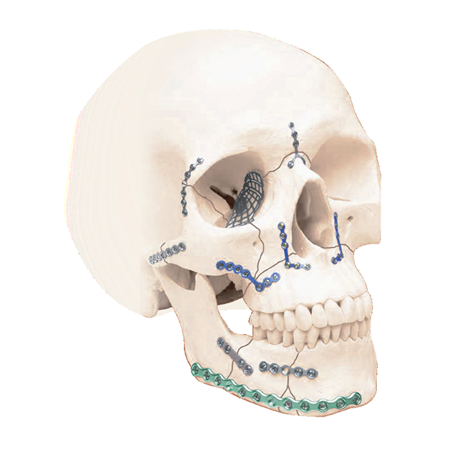 medtrix craniomaxillofacial system
