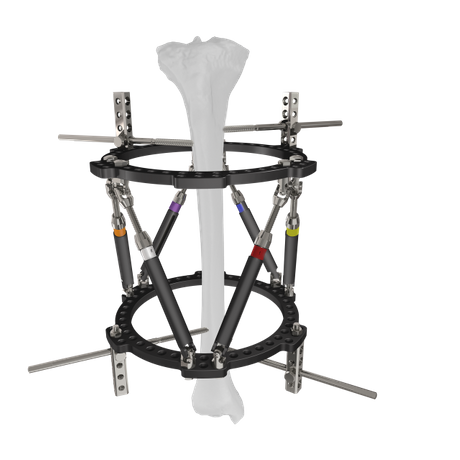 Trauhui Titan-Fix Circular External Fixation Support