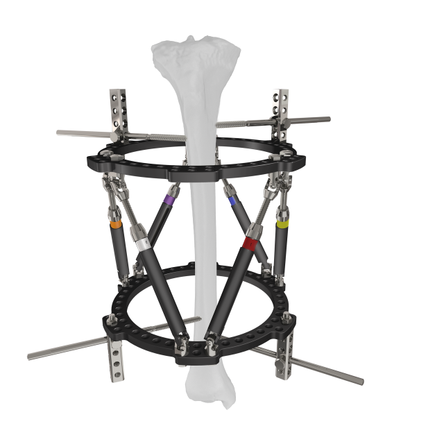 Trauhui Titan-Fix дөңгелек дөңгелектерді сыртқы бекіту