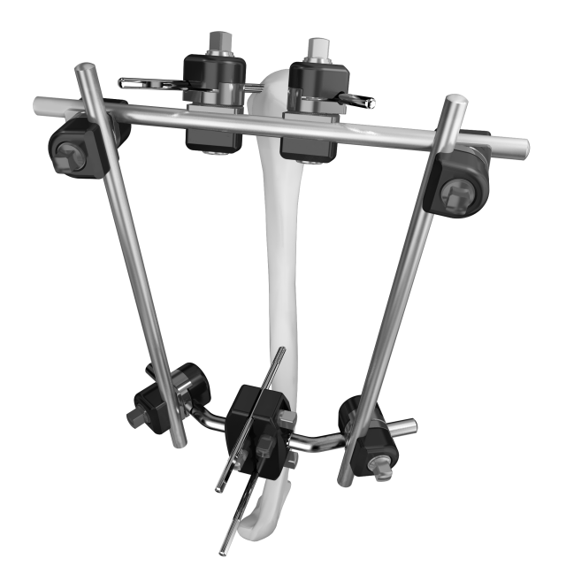 دعم التثبيت الخارجي Trauhui Titan-Fix