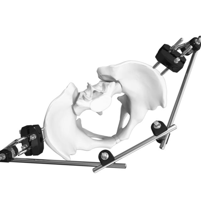 دعم التثبيت الخارجي Trauhui Titan-Fix