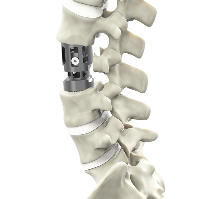 Copmpopic Sorpectomy Symptomiy
