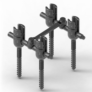 Orqa miya orqa fiksatsiyasi tizimi - CSS 